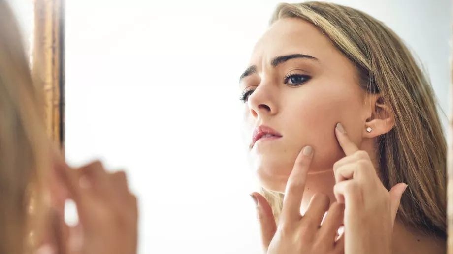 Тези 5 неща по лицето издават, че имате проблеми с черния дроб