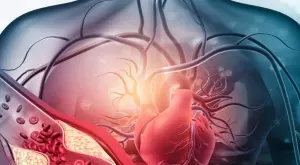 Яжте тези храни за чисти артерии