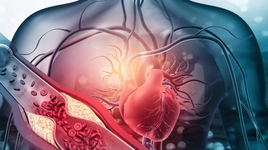 Високият холестерол може да причини смущения в съня 