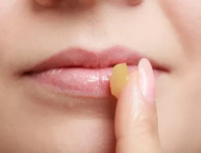 10 причини защо се напукват устните