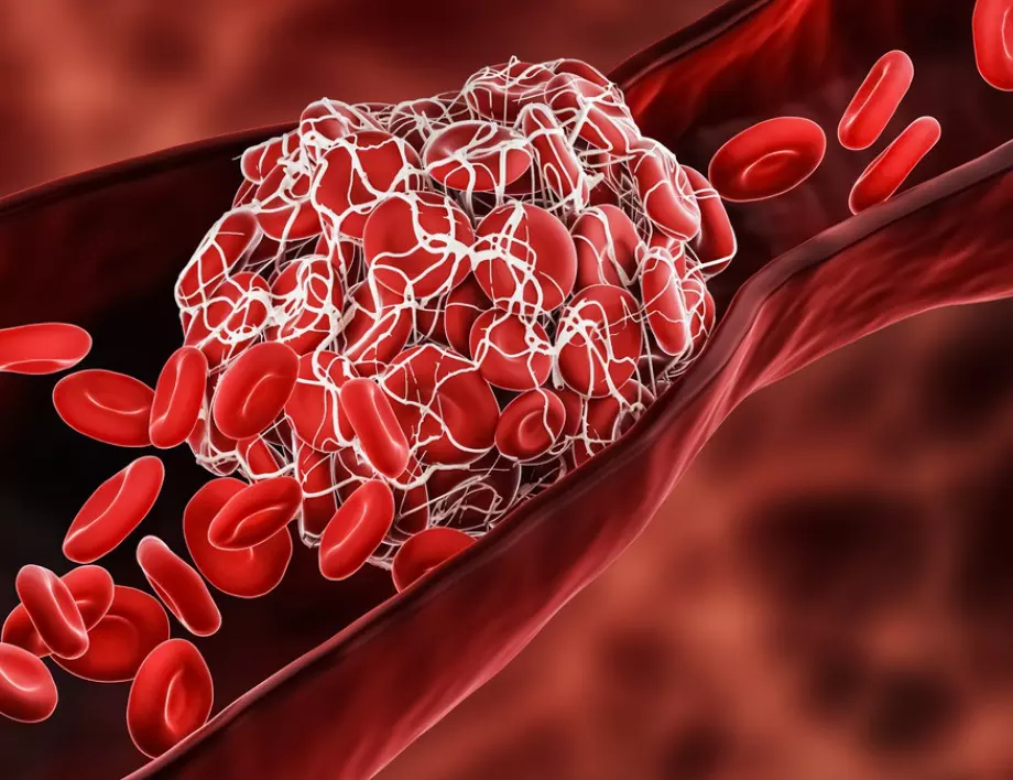 Този плод чисти токсините и холестерола от артериите - яжте го всеки ден