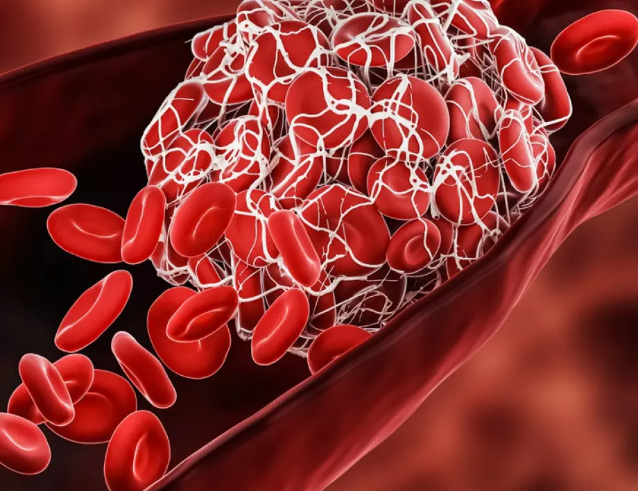 Кардиолог: Тези 2 продукта чистят кръвоносните съдове перфектно