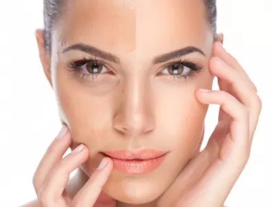 8 тайни на красивата кожа, които дори дерматолозите няма да ви кажат