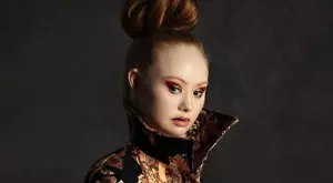 6 модела със синдром на Даун, които разбиха стереотипите