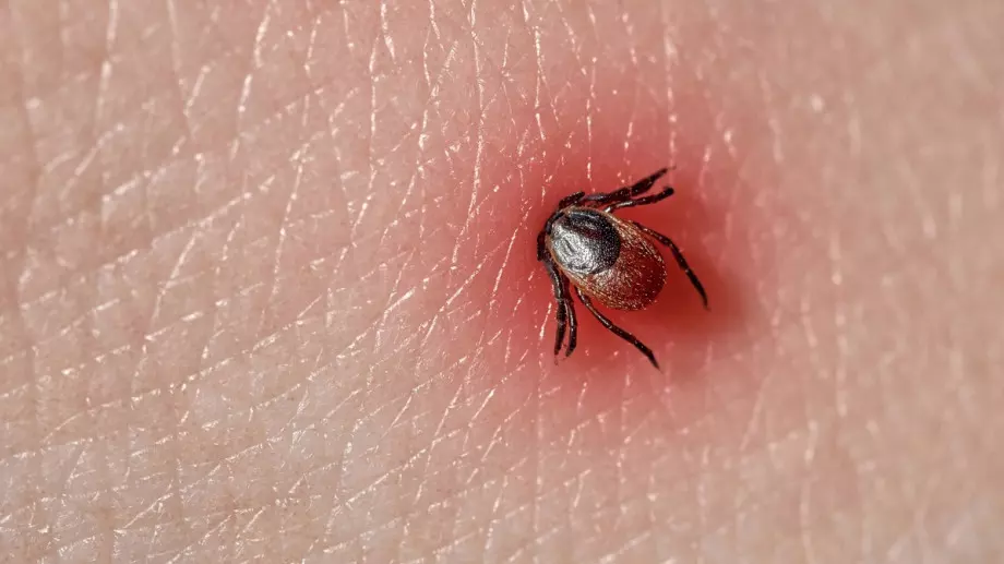 5 неща, които никога не трябва да правите при вадене на кърлеж