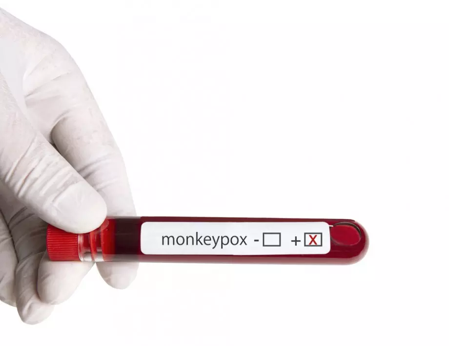 България може да получи от ЕК 1800 ваксини срещу маймунска шарка