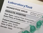 В САЩ се готвят да стартират ваксинация срещу маймунската шарка 