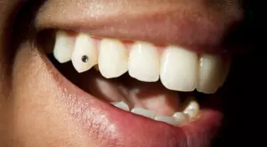 Ето защо маите са залепвали скъпоценни камъни по зъбите си