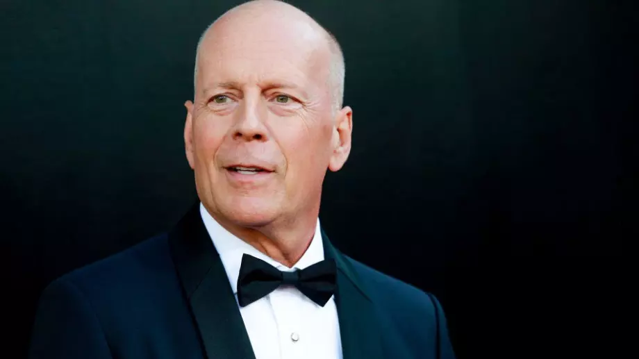 Брус Уилис е диагностициран с нелечима деменция