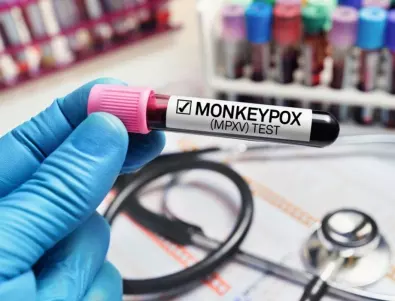 СЗО: Има повече от 70 000 случая на маймунска шарка от началото на епидемията