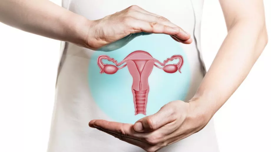 Всичко, което трябва да знаете за поликистозните яйчници