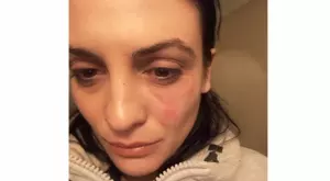 Ставате ли повече мъже, като биете и удряте?