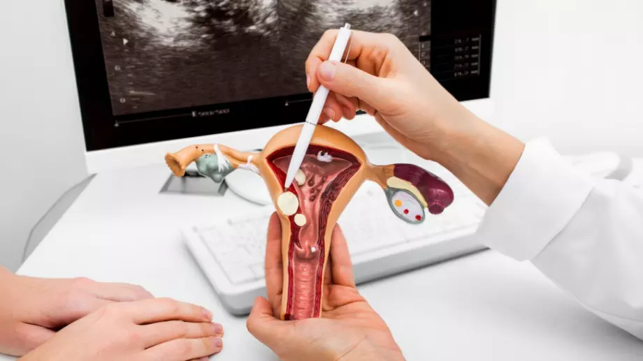 Избягвайте тези продукти, причиняват безплодие 