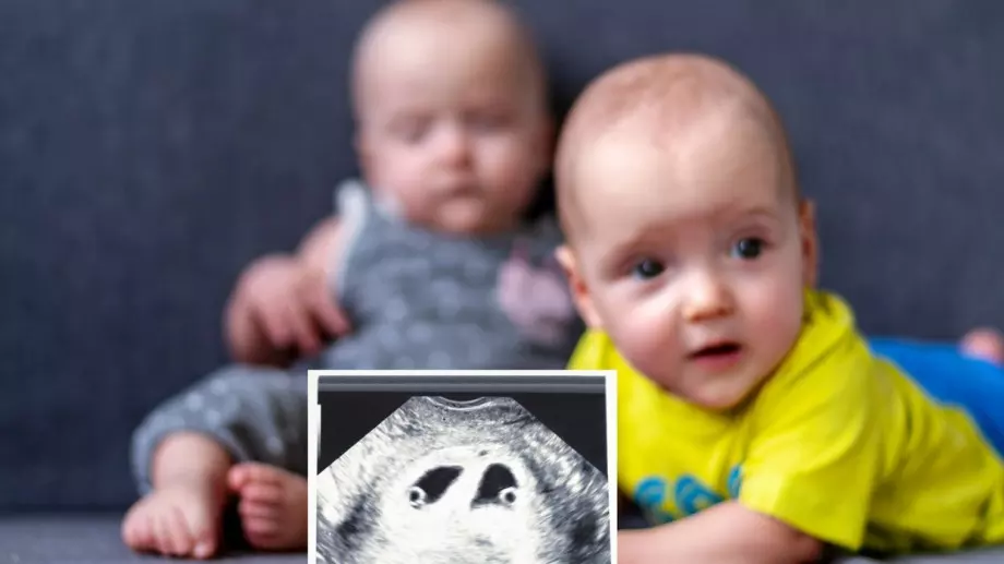 Жена забременя отново, докато е бременна (ВИДЕО + СНИМКИ)