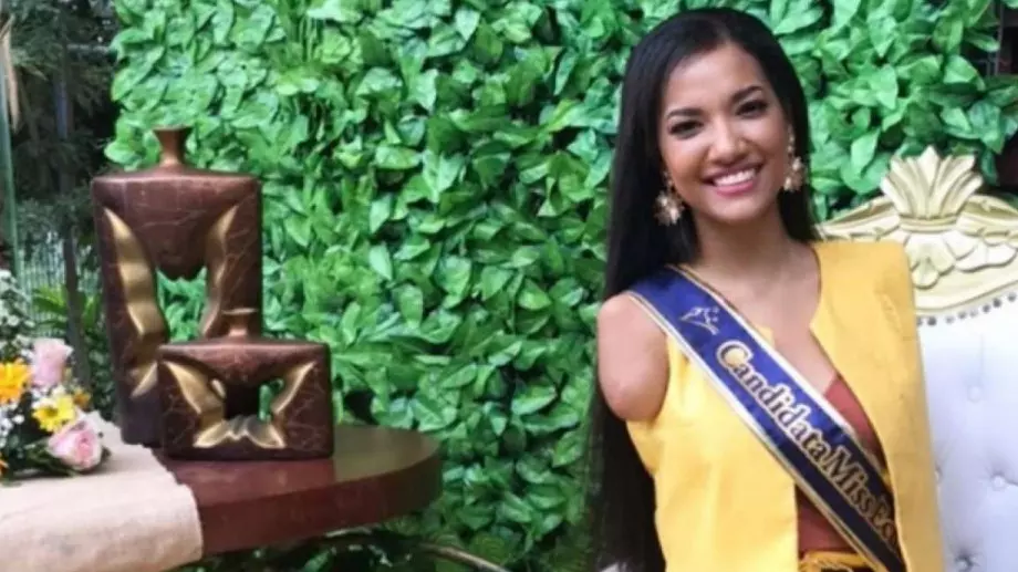 Мис Еквадор 2021: Имам 3 ампутации, но съм секси (ВИДЕО)