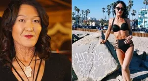 Жена с рядко кожно заболяване учи хората да обичат себе си различни (СНИМКИ)