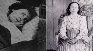 Жената, която прекарала повече от 30 години в сън след зъбобол (ВИДЕО)