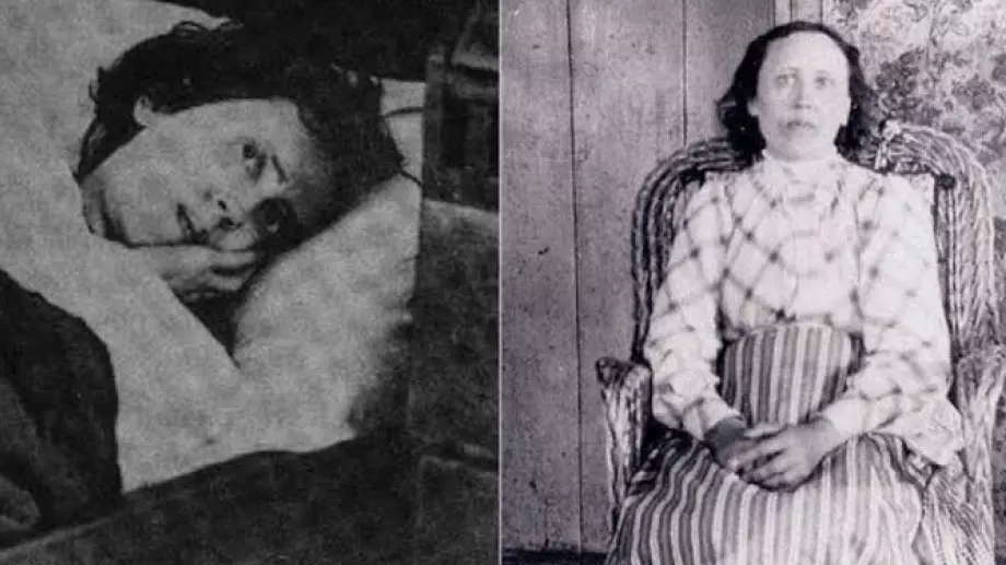 Жената, която прекарала повече от 30 години в сън след зъбобол (ВИДЕО)