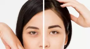 Натурална смес срещу тъмни кръгове под очите