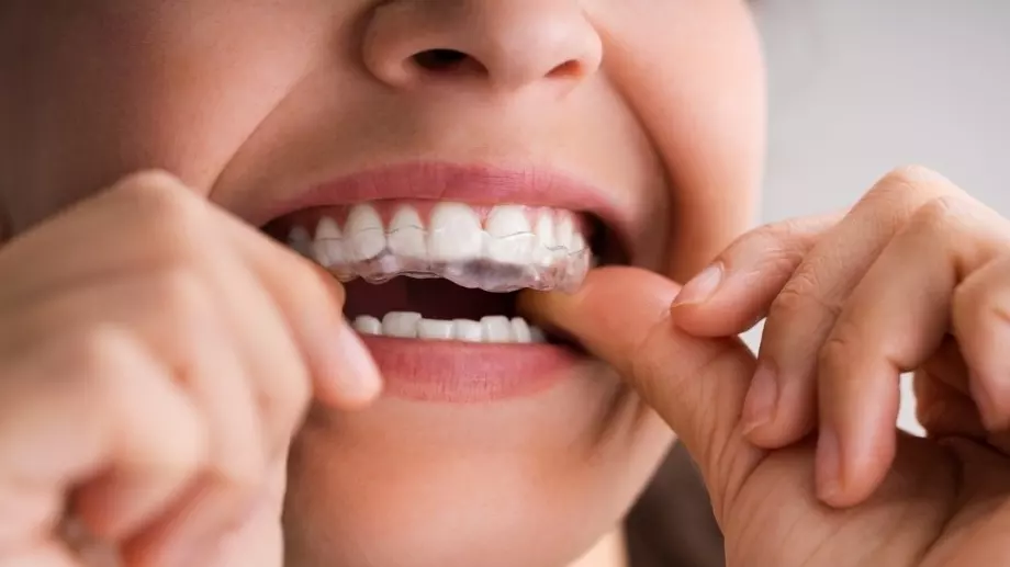 Вредни ли са избелващите ленти за зъби