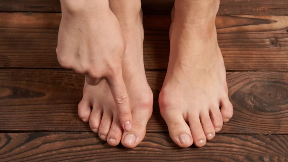 Имате гъбички по ноктите? Опитайте тези 6 натурални средства