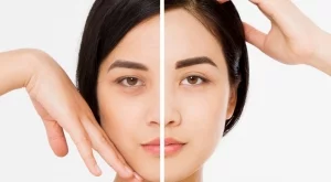 Ето какво да направите, ако искате да се отървете от тъмните кръгове под очите