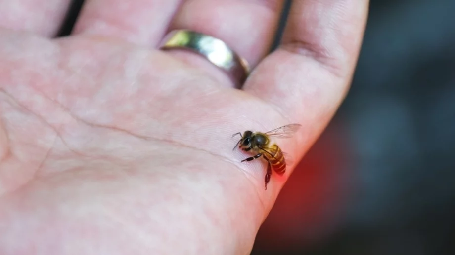 Първа помощ при ухапване от пчели или оси, ако сте алергични 