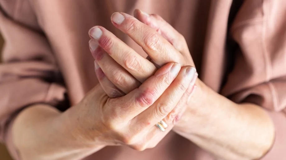 Псориазис - всичко, което трябва да знаем + домашни методи за лечение