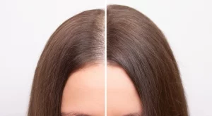 5 неща, които не осъзнавате, че причиняват изтъняване на косата ви