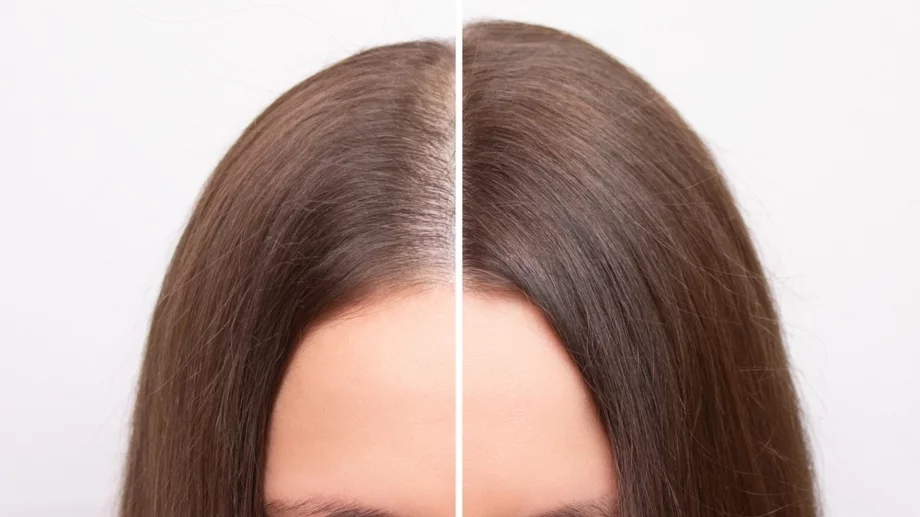 5 неща, които не осъзнавате, че причиняват изтъняване на косата ви
