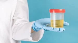 Обърнете внимание: Какво означава различният цвят на урината (СНИМКИ)