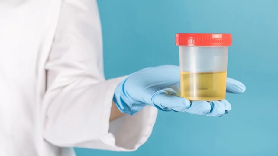 Обърнете внимание: Какво означава различният цвят на урината (СНИМКИ)