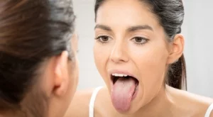 Защо езикът ви побелява и 8 начина да се справите с този проблем