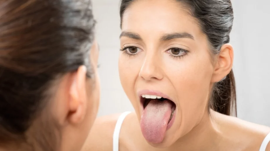 Защо езикът ви побелява и 8 начина да се справите с този проблем