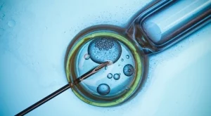 Инвитро - всичко, което трябва да знаете за процедурата