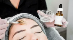 Всичко, което трябва да знаете, преди да си направите химически пилинг