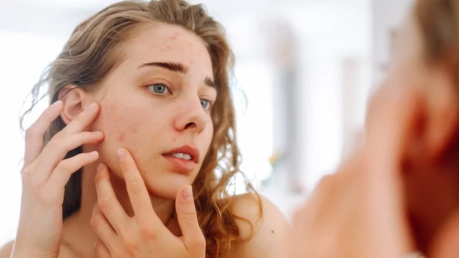 5 грешки, които правите, когато ви се появи пъпка