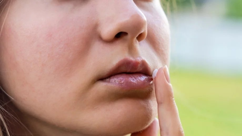 7 лесни средства, за които вашите сухи устни ще ви бъдат благодарни