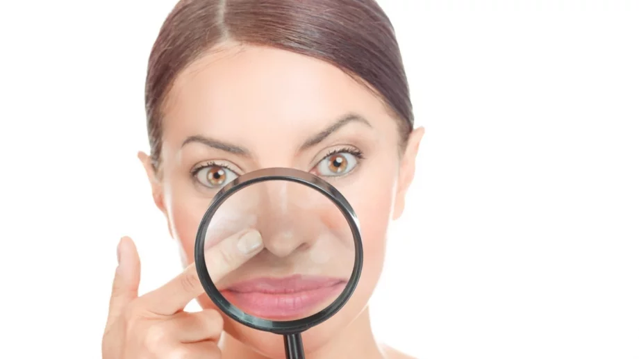 3 естествени начина да се отървете от черните точки