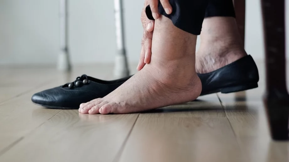 Защо имате подути глезени и как да се справите с проблема