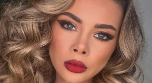 Участничка в "Ергенът" също пострадала от ботокс