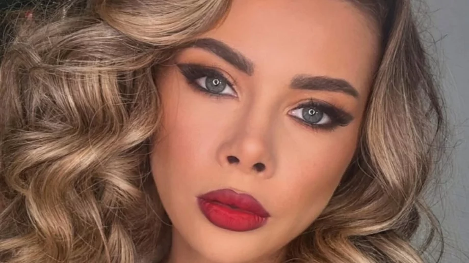 Участничка в "Ергенът" също пострадала от ботокс