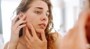 Как да се гримирате, когато имате акне (ВИДЕО)