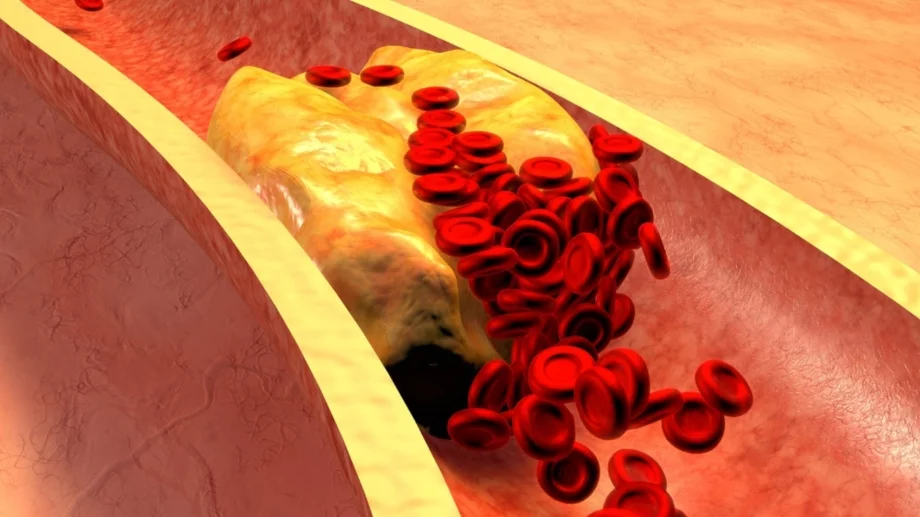 Всичко, което трябва да знаете за холестерола 