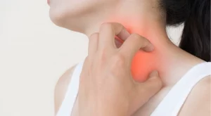 Изключете тези храни и напитки от диетата си и ще забравите за уртикарията 