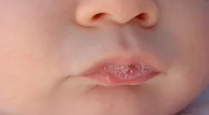 3 тайни послания във вашата слюнка, които не бива да игнорирате