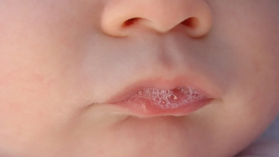 3 тайни послания във вашата слюнка, които не бива да игнорирате