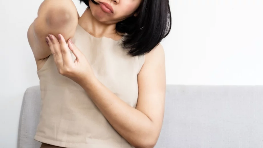 6 проблема с кожата на лактите, които издават здравословни проблеми