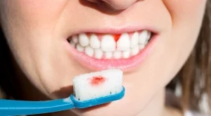 Зъбите ви кървят при миене? Може да е знак за сериозен проблем