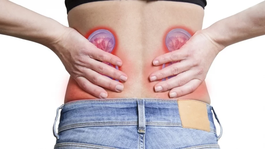 Хранете се така, за да предотвратите появата на камъни в бъбреците 